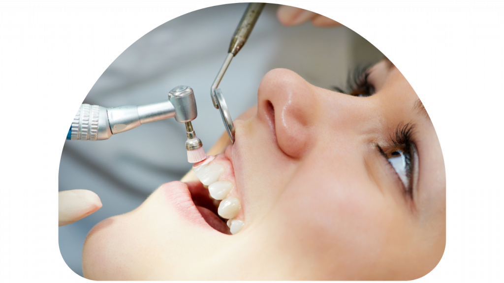 Cleaning and polishing of teeth