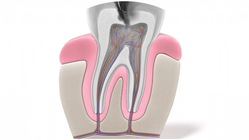 Endodontics