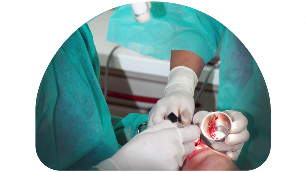 Oral and maxillofacial surgery