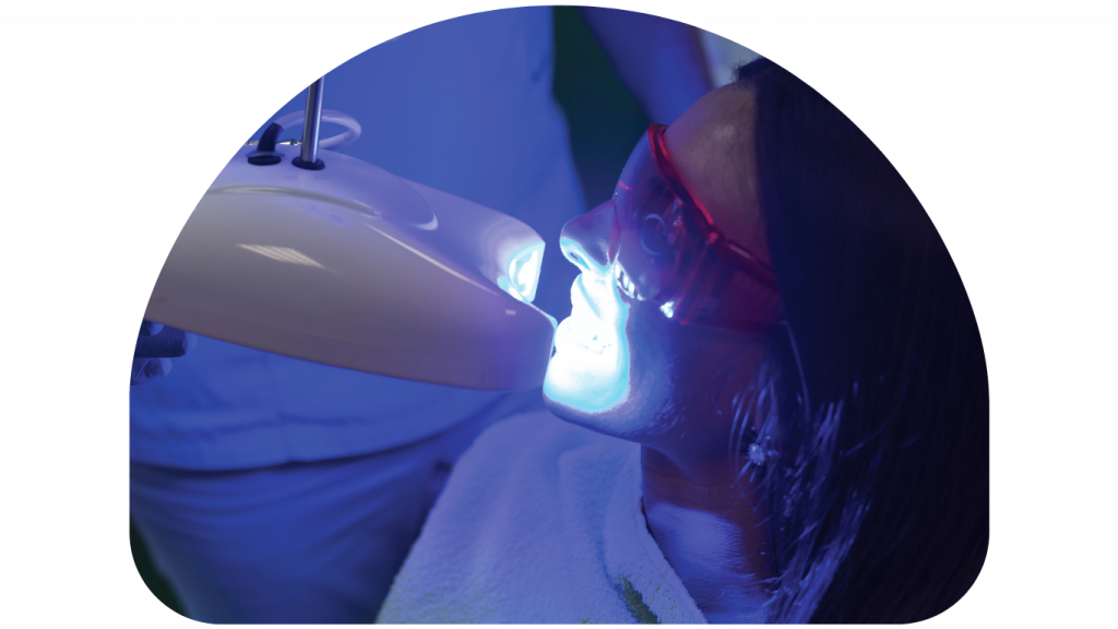 laser treatments